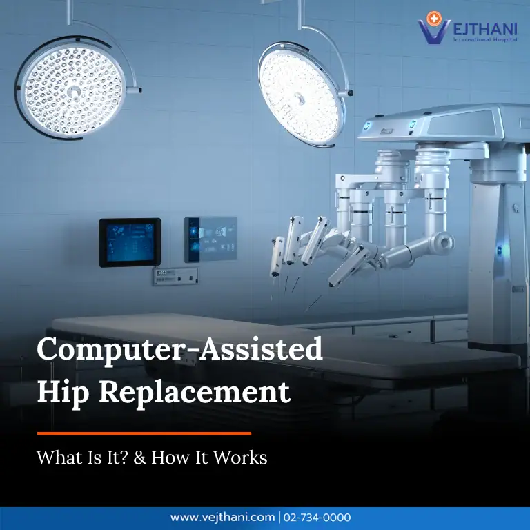 Computer-Assisted Hip Replacement