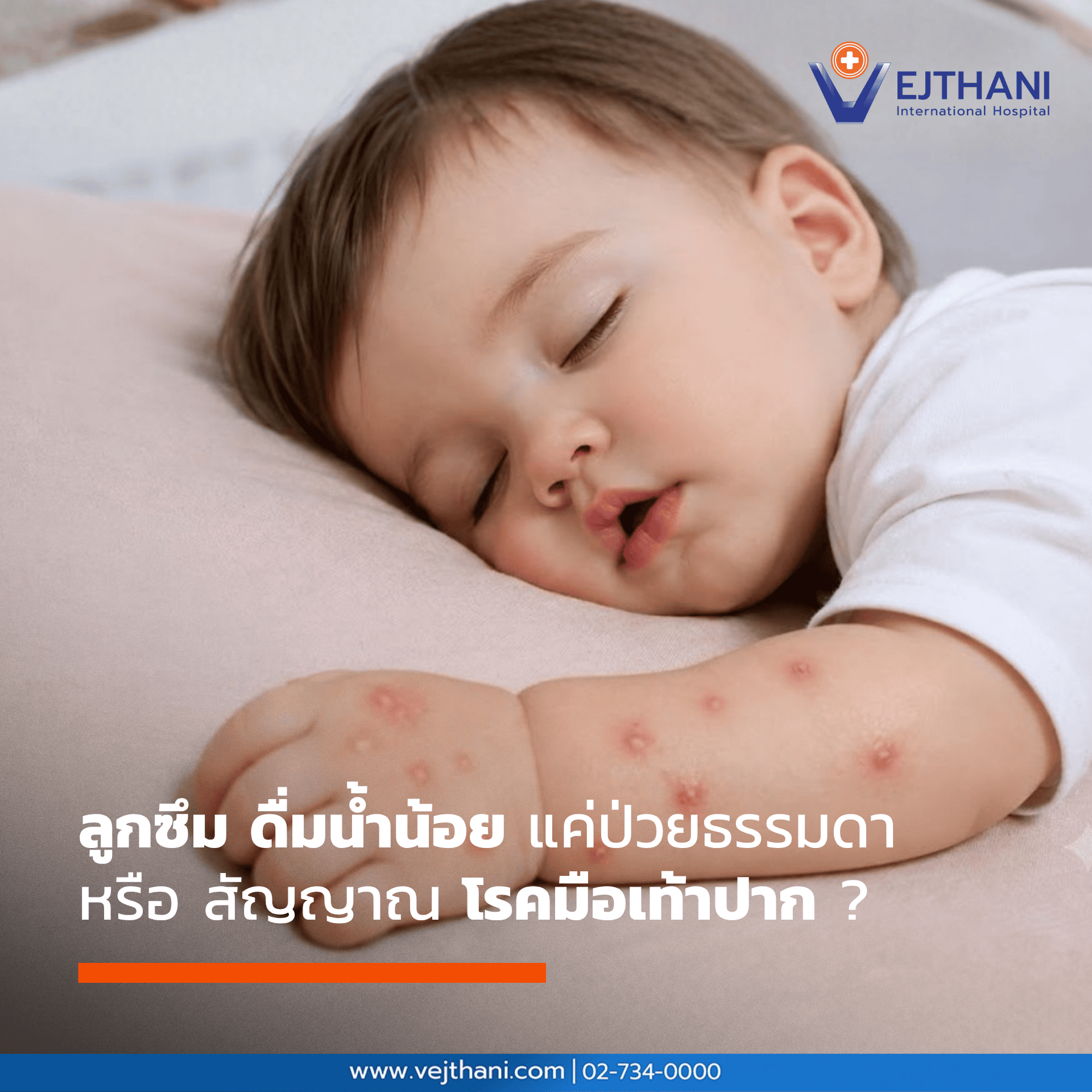 โรคมือเท้าปาก มีผื่นขึ้นที่มือ เท้า ปาก 