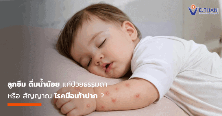 โรคมือเท้าปาก