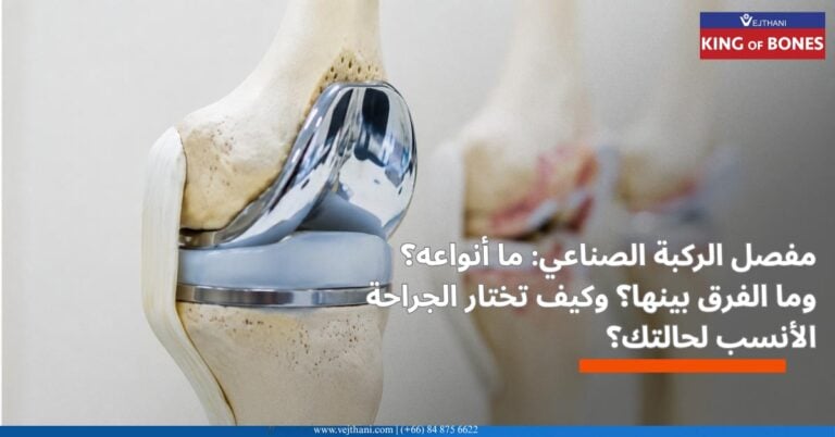 مفصل ركبة صناعي