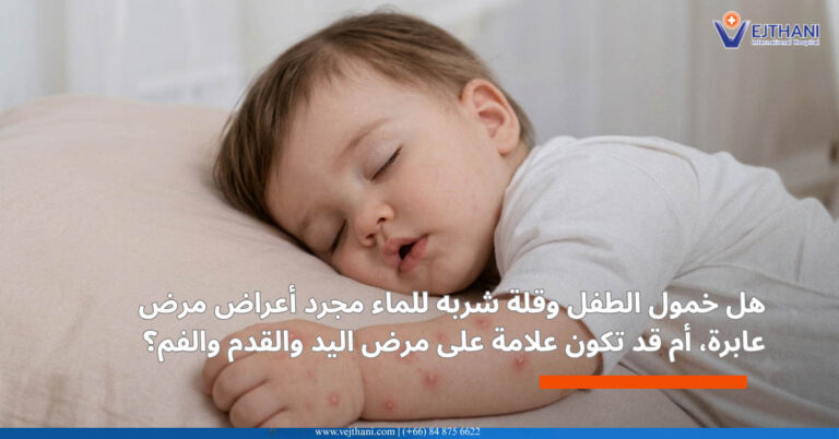 متلازمة اليد والقدم