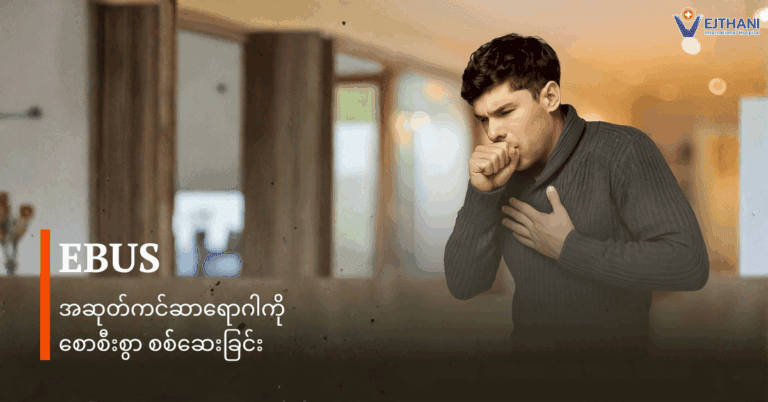အဆုတ်ကင်ဆာ
