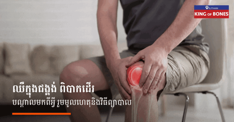ការឈឺក្នុងជង្គង់ ពិបាកដើរ បណ្ដាលមកពីអ្វី រោគសញ្ញាបែបណាគួរទៅជួបវេជ្ជបណ្ឌិត