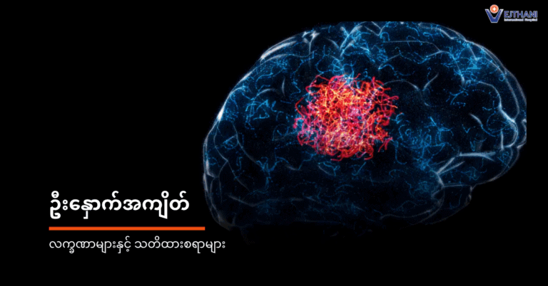 ဦးနှောက်အကျိတ်၏သတိပေးလက္ခဏာ(၉)ချက်