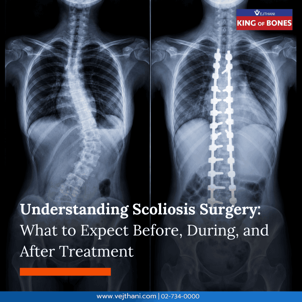 Scoliosis Surgery