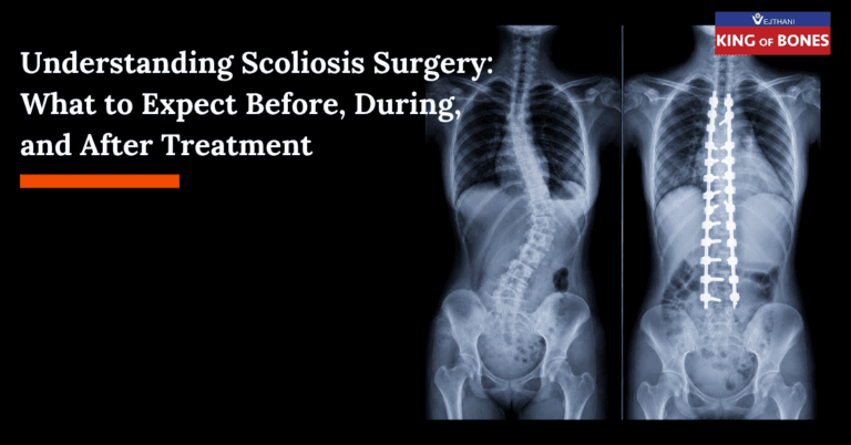 Scoliosis Surgery