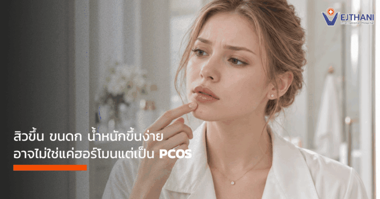 PCOS