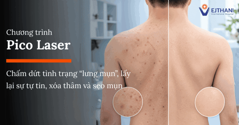 Pico Laser: Giải Pháp Xử Lý Lưng Nổi Mụn, Xóa Mờ Vết Thâm Và Sẹo Mụn