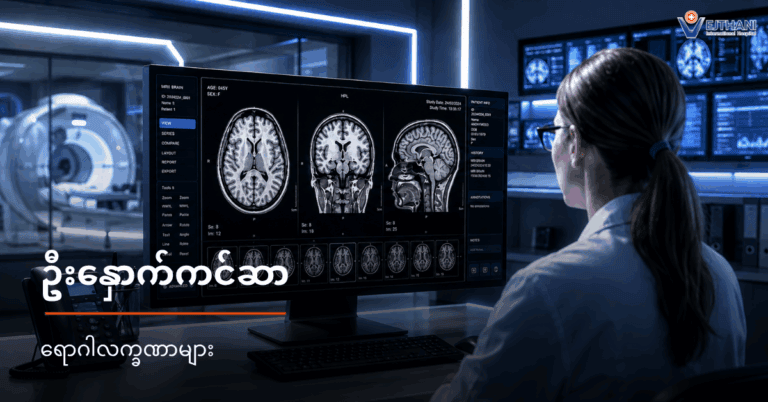 ဦးနှောက်ကင်ဆာ