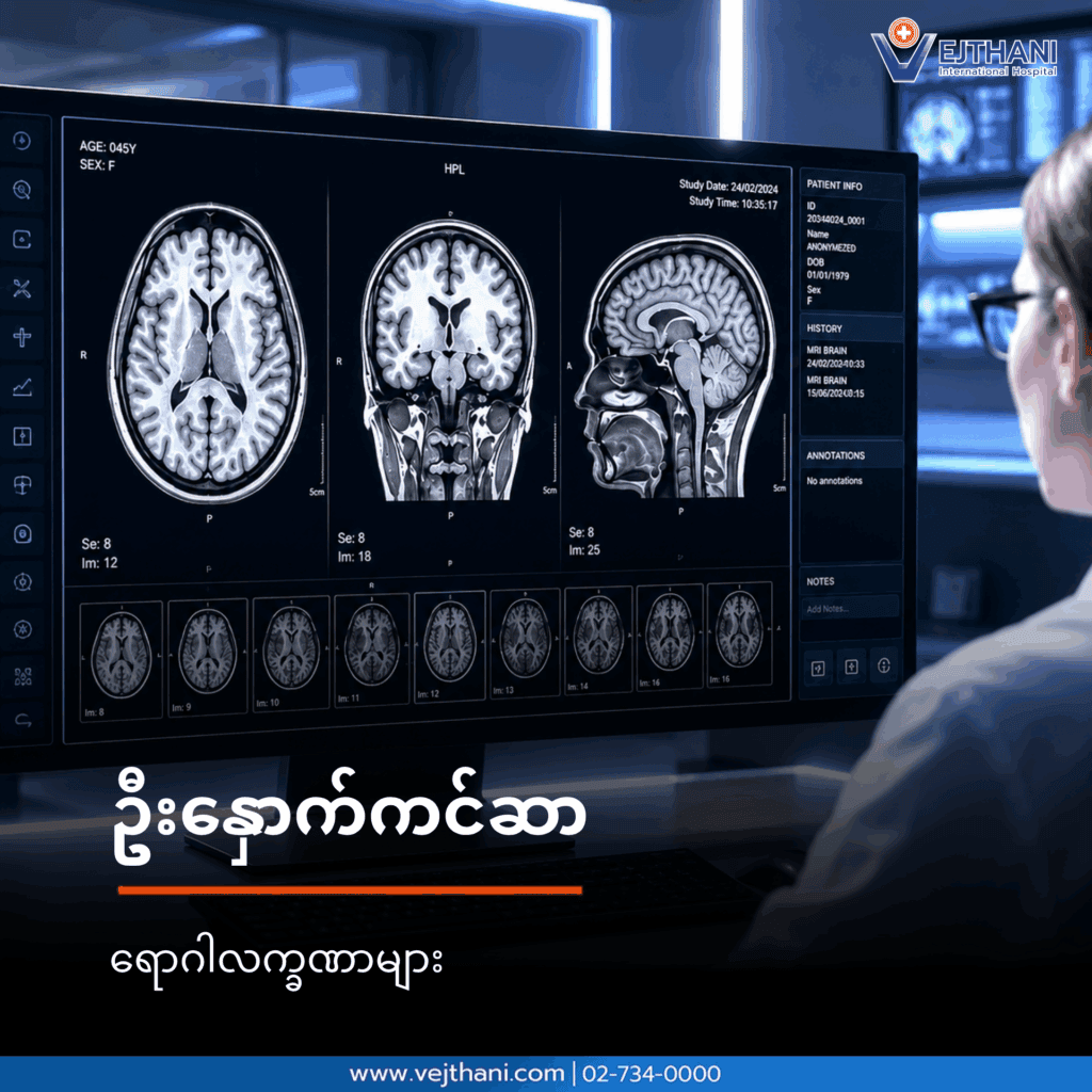 ဦးနှောက်ကင်ဆာ
