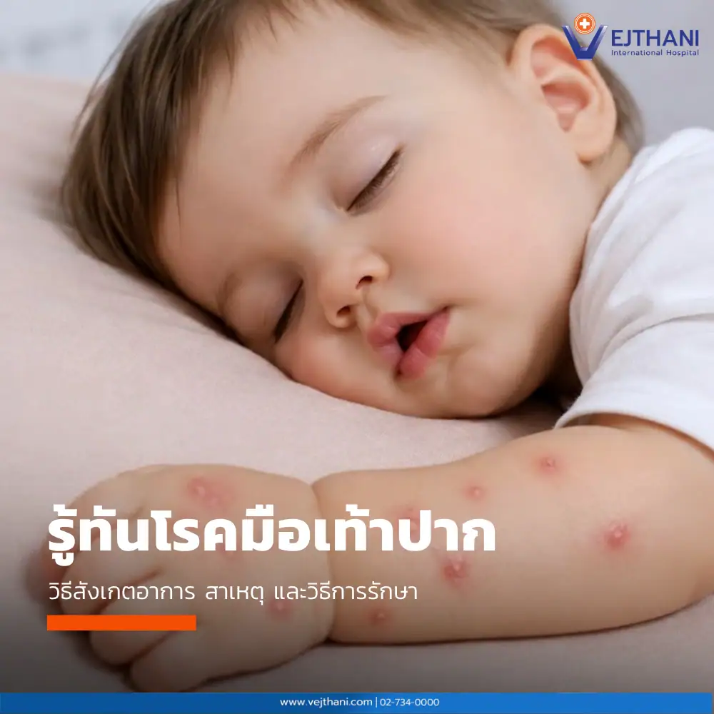 เด็กทารกกำลังนอนหลับ แสดงผื่นแดงและตุ่มใสบริเวณแขน ซึ่งเป็นอาการของโรคมือเท้าปาก พร้อมแนะนำวิธีสังเกตอาการ สาเหตุ และวิธีรักษา โดยโรงพยาบาลเวชธานี อินเตอร์เนชันแนล