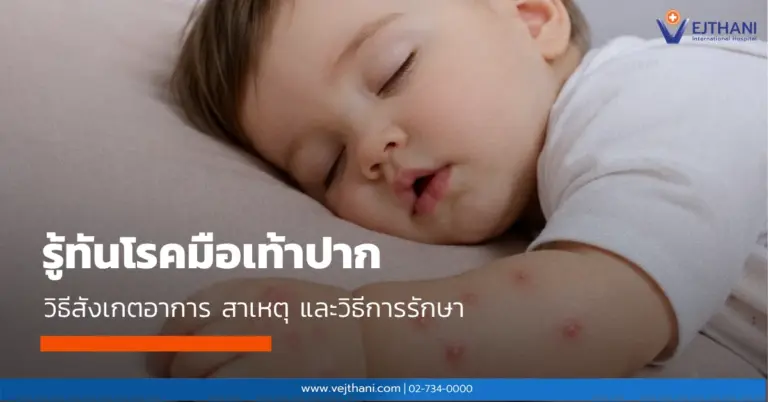 เด็กทารกกำลังนอนหลับ แสดงผื่นแดงและตุ่มใสบริเวณแขน ซึ่งเป็นอาการของโรคมือเท้าปาก พร้อมแนะนำวิธีสังเกตอาการ สาเหตุ และวิธีรักษา โดยโรงพยาบาลเวชธานี อินเตอร์เนชันแนล