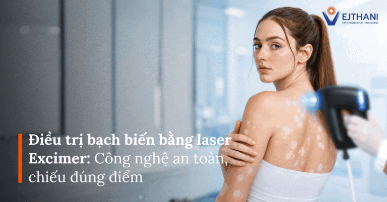 Điều trị bạch biến bằng laser Excimer | Vejthani