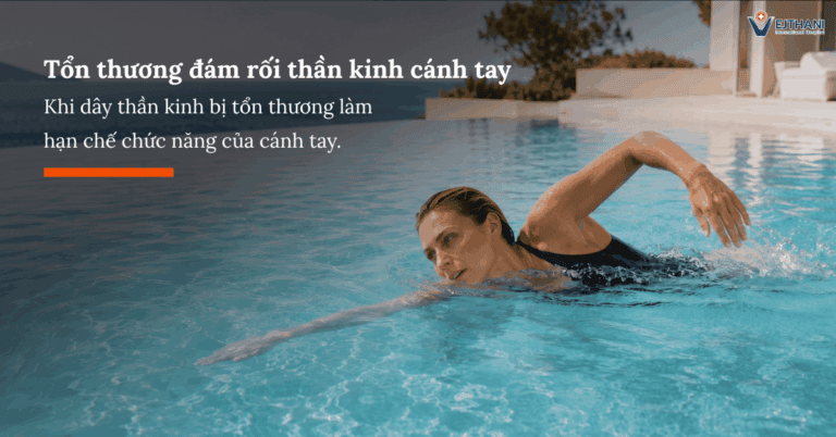 Chấn thương đám rối thần kinh cánh tay