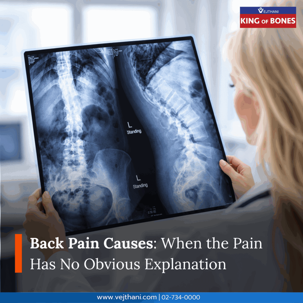 Back Pain Causes