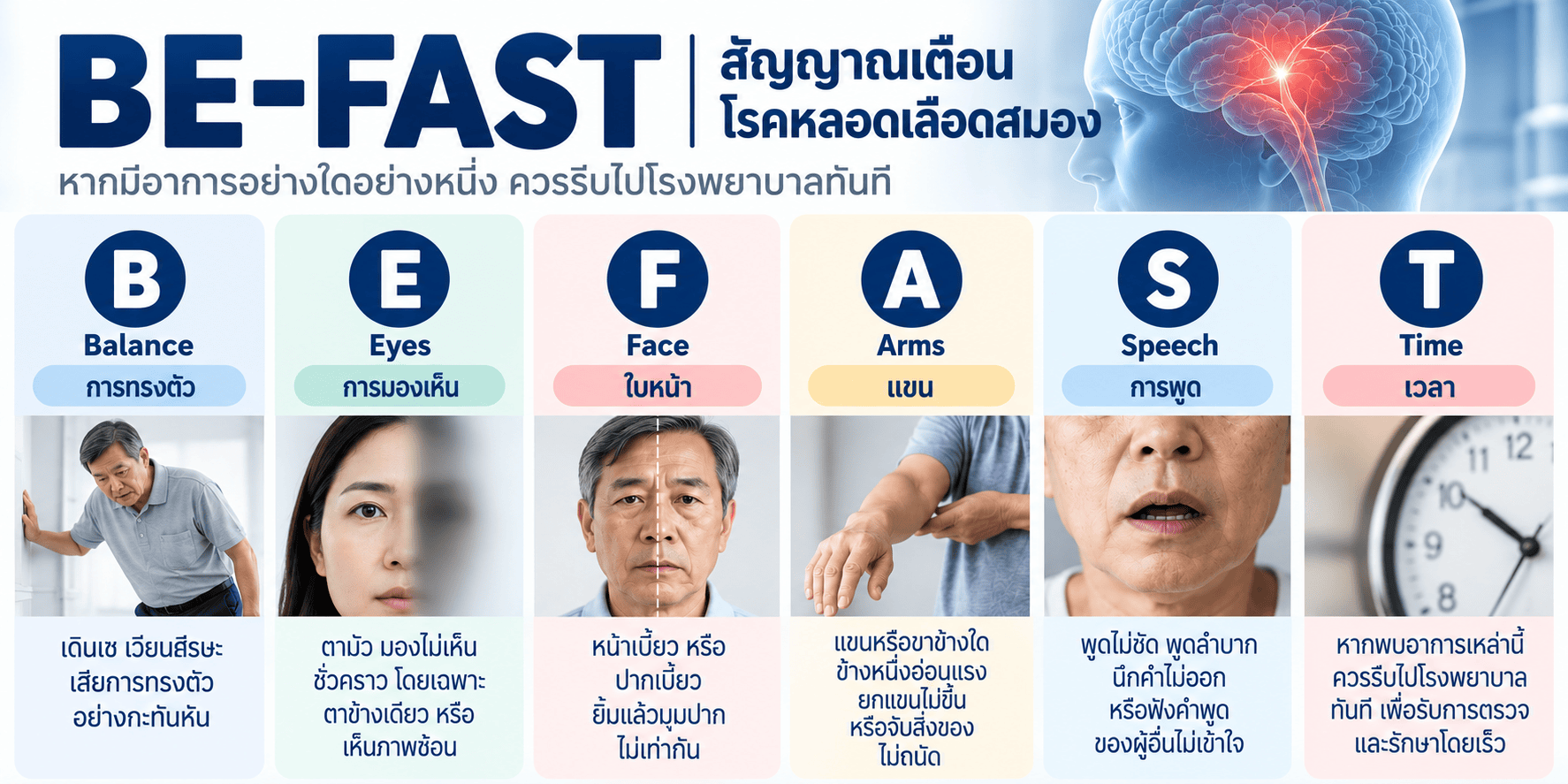 อาการ TIA มักเกิดขึ้นอย่างกะทันหัน โดยอาจพบเพียงอาการเดียวหรือหลายอาการร่วมกันตามหลัก BE FAST ได้แก่